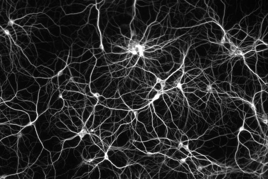 تصویر شبکه های عصبی