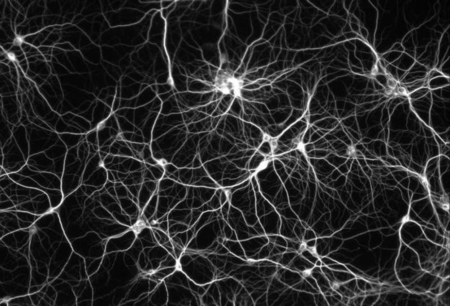 شبکه های عصبی